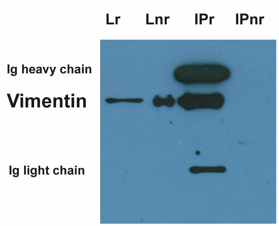 IP analysis of HeLa cell lysate using GTX40346 Vimentin antibody [VI-10] . The signal wass detected by GTX27752 Vimentin antibody [VI-01] in WB assay. Lr : Lysate (reducing conditions) Lnr : Lysate (non-reducing conditions) IPr : Immunoprecipitate (reducing conditions) IPnr : Immunoprecipitate (non-reducing conditions)
