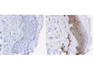 WB analysis using beta 2 Microglobulin antibody (HRP). Load: 50 ng Beta-2-Microglobulin. Predicted/Observed size: 12 kDa.