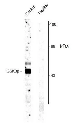 WB analysis of rat cortex tissue lysate using GTX40875 GSK3 beta (phospho Ser9) antibody. WB analysis of rat cortex tissue lysate using GTX40875 GSK3 beta (phospho Ser9) antibody.