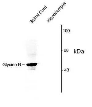 WB analysis of rat spinal cord and hippocamapus tissue lysate using GTX40945 Glycine Receptor alpha 1/2 antibody, N-term. WB analysis of rat spinal cord and hippocamapus tissue lysate using GTX40945 Glycine Receptor alpha 1/2 antibody, N-term.