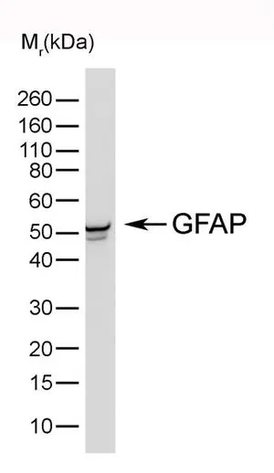 WB analysis of rat cerebrum tissue lysate using GTX40985 GFAP antibody [4A11].