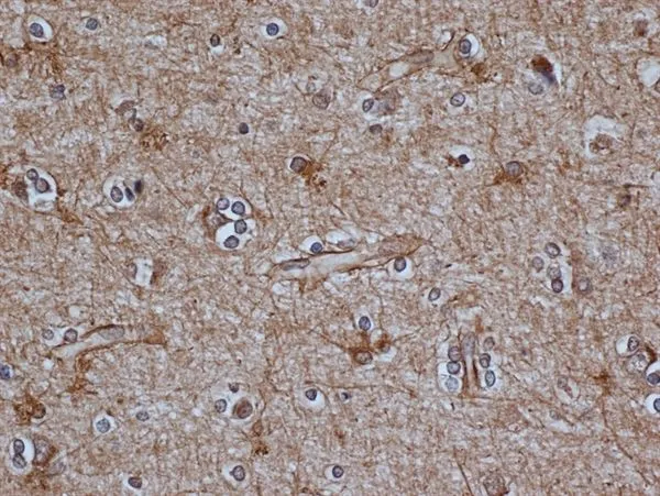 IHC-P analysis of human brain tissue using GTX40988 GFAP antibody. Enzyme mediated antigen retrieval using pronase. IHC-P analysis of human brain tissue using GTX40988 GFAP antibody. Enzyme mediated antigen retrieval using pronase.