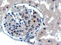 IHC-P analysis of human kidney using GTX41193 UBE2I antibody,N-term. Antigen retrieval : Tris/EDTA buffer pH 9 Dilution : 0.3ug/ml