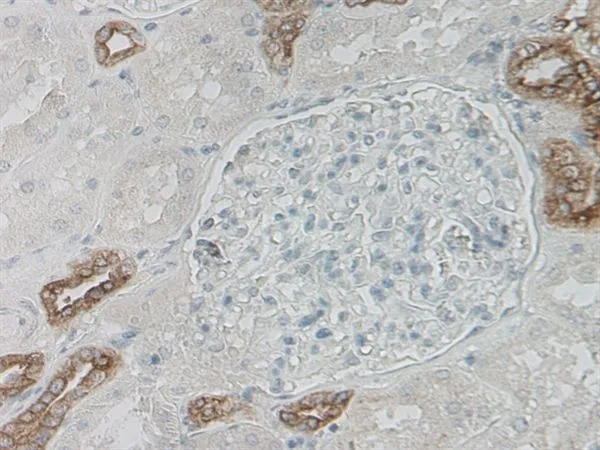 IHC-P analysis of human kidney tissue using GTX41451 Defensin beta 1 antibody. Antigen retrieval using citrate buffer at pH6.0. IHC-P analysis of human kidney tissue using GTX41451 Defensin beta 1 antibody. Antigen retrieval using citrate buffer at pH6.0.