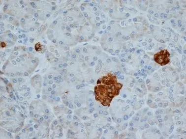 IHC-P analysis of human pancreas tissue using GTX41688 Chromogranin A antibody [LK2H10].