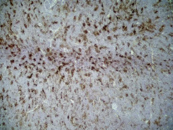IHC-Fr analysis of rat lymph node tissue using GTX41788 CD86 antibody [24F].