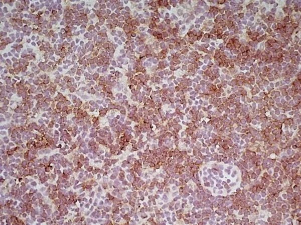 IHC-Fr analysis of mouse lymph node tissue using GTX41817 CD8 antibody [YTS169.4].