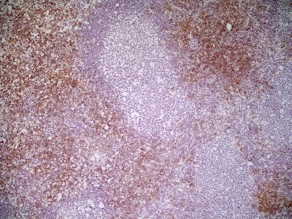 IHC-Fr analysis of mouse lymph node tissue using GTX41817 CD8 antibody [YTS169.4].