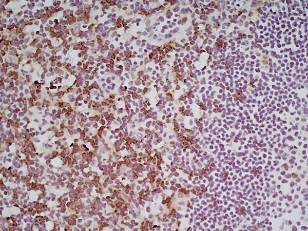 IHC-Fr analysis of mouse lymph node tissue using GTX41819 CD8 antibody [YTS105.18] (Low endotoxin, azide free).