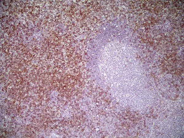 IHC-Fr analysis of mouse lymph node tissue using GTX41819 CD8 antibody [YTS105.18] (Low endotoxin, azide free).