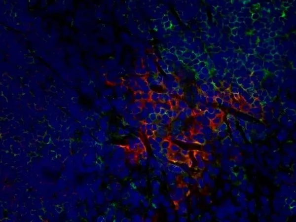 IHC-Fr analysis of rat lymph node with Mouse anti Rat CD25 antibody, clone OX-35, red in A and Mouse anti Rat CD8 antibody, clone OX-8 (GTX41830), green in B. C is the merged image with nuclei counterstained blue using DAPI. High power