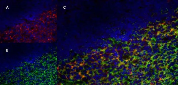 IHC-Fr analysis of a human tonsil with Mouse anti Human CD70 antibody, clone Bu69 (GTX41859), red in A and Mouse anti Human CD21 antibody, clone LB21 (:GTX74728), green in B. C is the merged image with nuclei counterstained blue using DAPI. High power