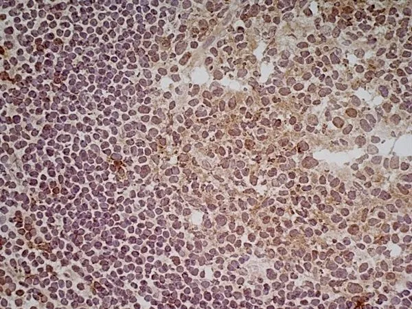 IHC-Fr analysis of human tonsil tissue using GTX41859 CD70 antibody [Bu69].