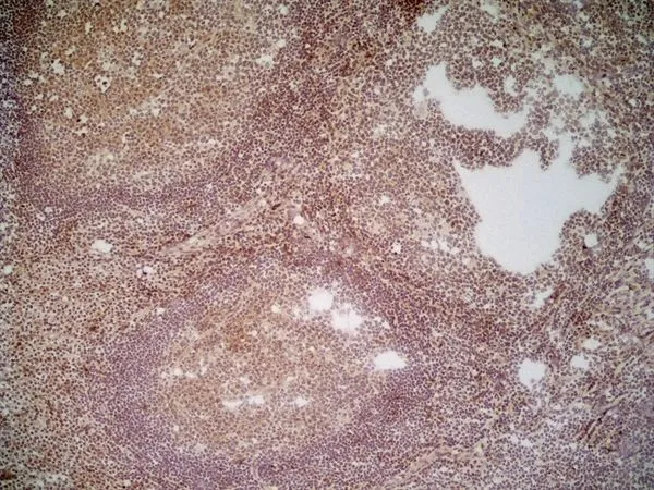 IHC-Fr analysis of human tonsil tissue using GTX41859 CD70 antibody [Bu69].