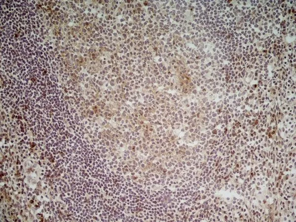 IHC-Fr analysis of human tonsil tissue using GTX41859 CD70 antibody [Bu69].
