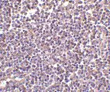 IHC analysis of human lymph node tissue using GTX41902 CD5L antibody, N-term.