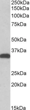 WB analysis of HEK293 lysate using GTX41958 CBR3 antibody, C-term. Dilution : 0.5microg/ml Loading : 35microg protein in RIPA buffer WB analysis of HEK293 lysate using GTX41958 CBR3 antibody, C-term. Dilution : 0.5microg/ml Loading : 35microg protein in RIPA buffer