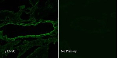 IF analysis of ENaC Gamma in rat kidney tissue using a dilution of GTX41972. IF analysis of ENaC Gamma in rat kidney tissue using a dilution of GTX41972.