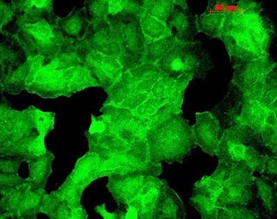 PSD95 visualized using GTX41974, tested on HaCat cells. PSD95 visualized using GTX41974, tested on HaCat cells.