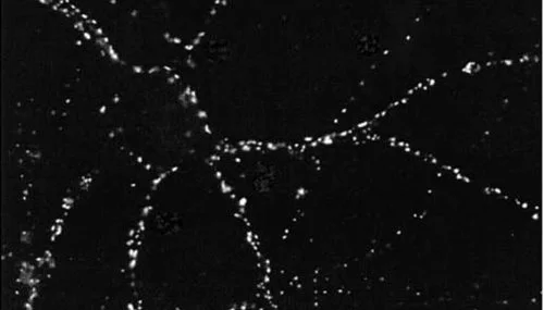 ICC of PSD95 in cultures of dissociated hippocampal neurons.?Cultures were grown and labeled with antibodies against the indicated proteins.? A neuron double stained for PSD95.