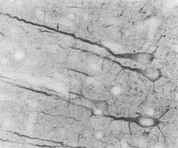 ICC localization of Psd95 in rat neocortex. ICC localization of Psd95 in rat neocortex.