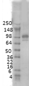 Western blot analysis of PSD95 in rat membrane using a 1:1000 dilution of GTX41975. Western blot analysis of PSD95 in rat membrane using a 1:1000 dilution of GTX41975.