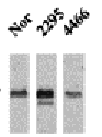 Three western blot analyses of CaMKII and NFAT phosphorylation in ventricles of 14 day old mice over-expressing CaMK.