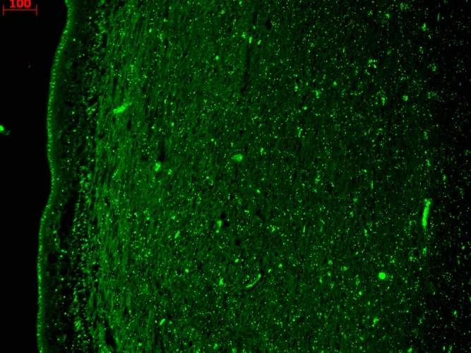 IHC-P analysis of human hippocampus tissue using GTX41990?KCNQ4 antibody [S43-6]. Dilution : 1:1000