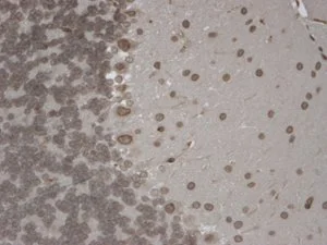IHC analysis of TrpM7 tested on mouse brain using a dilution of GTX41997. Strong positivity of the nuclear membrane of every cell.