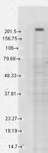 Western blot analysis of TrpM7 tested in a human cell line mix at 1:1000 dilution of GTX41997.