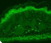 IF analysis of TrpV3 in human hippocampal tissues using GTX42000 IF analysis of TrpV3 in human hippocampal tissues using GTX42000