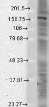 Western blot analysis of pan-shank in rat brain membrane lysates using a 1:1000 dilution of GTX42006. Western blot analysis of pan-shank in rat brain membrane lysates using a 1:1000 dilution of GTX42006.