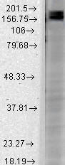 Western blot analysis of Shank2 in rat brain membrane lysates using a 1:1000 dilution of GTX42007. Western blot analysis of Shank2 in rat brain membrane lysates using a 1:1000 dilution of GTX42007.