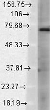 Western blot analysis of TrpV3 in rat brain membrane lysates using a 1:1000 dilution of GTX42013. Western blot analysis of TrpV3 in rat brain membrane lysates using a 1:1000 dilution of GTX42013.