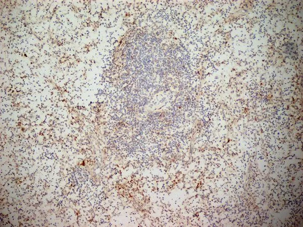 IHC-Fr analysis of human spleen tissue using GTX42086 NKG2D antibody [1D11].