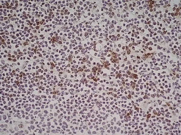 IHC-Fr analysis of human tonsil tissue using GTX42086 NKG2D antibody [1D11].