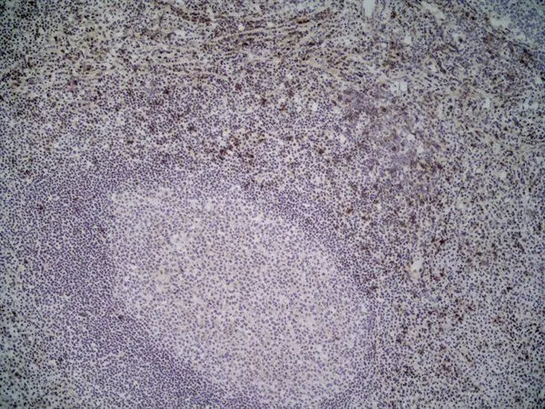 IHC-Fr analysis of human tonsil tissue using GTX42086 NKG2D antibody [1D11].