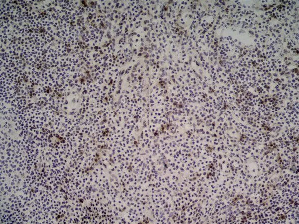 IHC-Fr analysis of human tonsil tissue using GTX42086 NKG2D antibody [1D11].