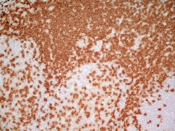IHC-Fr analysis of human tonsil tissue using GTX42102 CD3 antibody [UCHT1] (Low endotoxin, azide free).