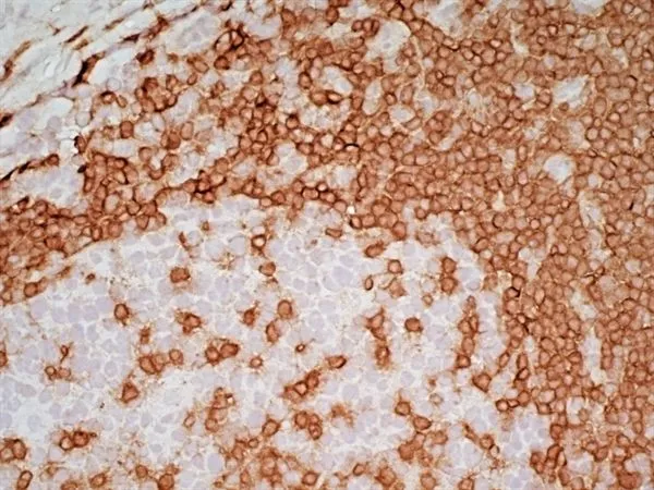 IHC-Fr analysis of human tonsil tissue using GTX42102 CD3 antibody [UCHT1] (Low endotoxin, azide free).