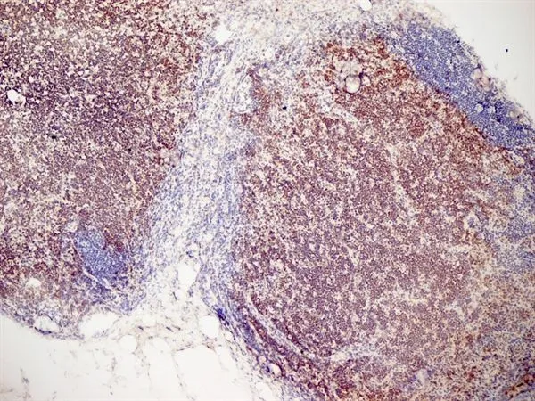 IHC-Fr analysis of mouse lymph node tissue using GTX42104 CD3 antibody [KT3].