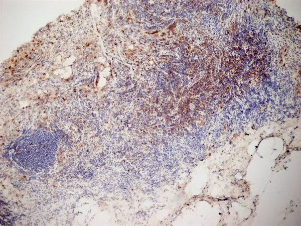 IHC-Fr analysis of mouse lymph node tissue using GTX42108 CD3 antibody [KT3] (Low endotoxin, azide free).