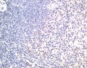 IHC-P analysis of human spleen tissue using GTX42181 DR5 antibody.