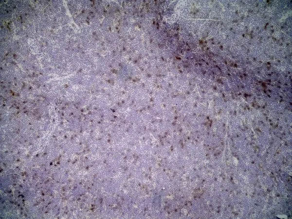 IHC-Fr analysis of rat lymph node with Mouse anti Rat CD25 (GTX42210) followed by horseradish peroxidase conjugated Goat anti Mouse IgG1 as a detection reagent.