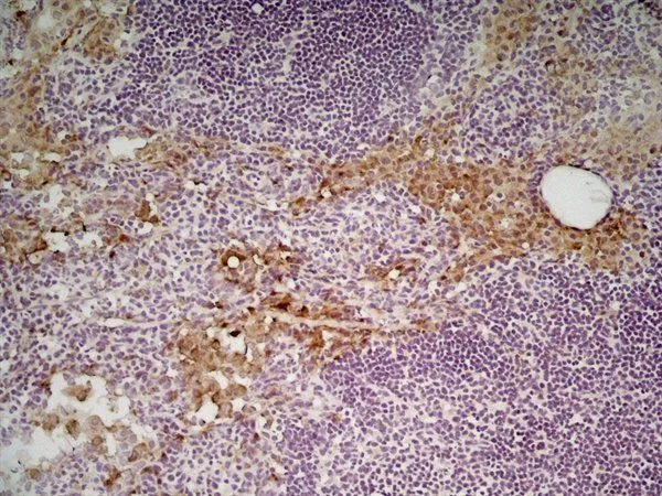 IHC-Fr analysis of mouse lymph node tissue using GTX42265 Mannose Receptor antibody [MR5D3].