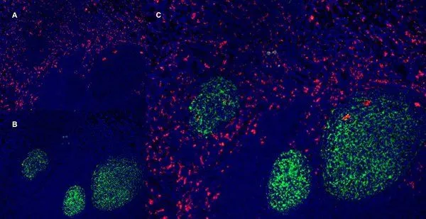 IHC-Fr staining of a human tonsil with Mouse anti Human CD163 antibody,clone EDHu-1 (GTX42365),red in A and Mouse anti Human CD21 antibody,clone LB21 (GTX74728),green in B. C is the merged image with nuclei counterstained blue using DAPI. Low power