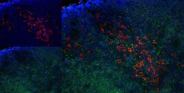 IHC-Fr staining of rat lymph node with Mouse anti Rat CD163 antibody (GTX42367), red an A and Mouse anti Rat CD8, green in B. C is the merged image with nuclei counter-stained blue using DAPI. High power IHC-Fr staining of rat lymph node with Mouse anti Rat CD163 antibody (GTX42367), red an A and Mouse anti Rat CD8, green in B. C is the merged image with nuclei counter-stained blue using DAPI. High power