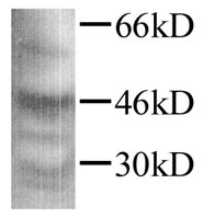 Mature porcine TGFB1 detected in fibroblasts