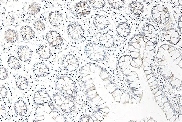 IHC-P analysis of human small bowel tissue using GTX42535 CCL25 antibody. IHC-P analysis of human small bowel tissue using GTX42535 CCL25 antibody.
