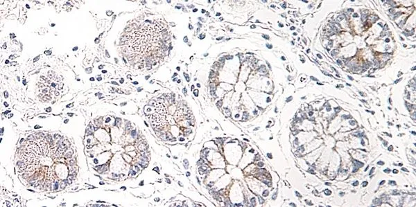 IHC-P analysis of human small bowel tissue using GTX42535 CCL25 antibody.